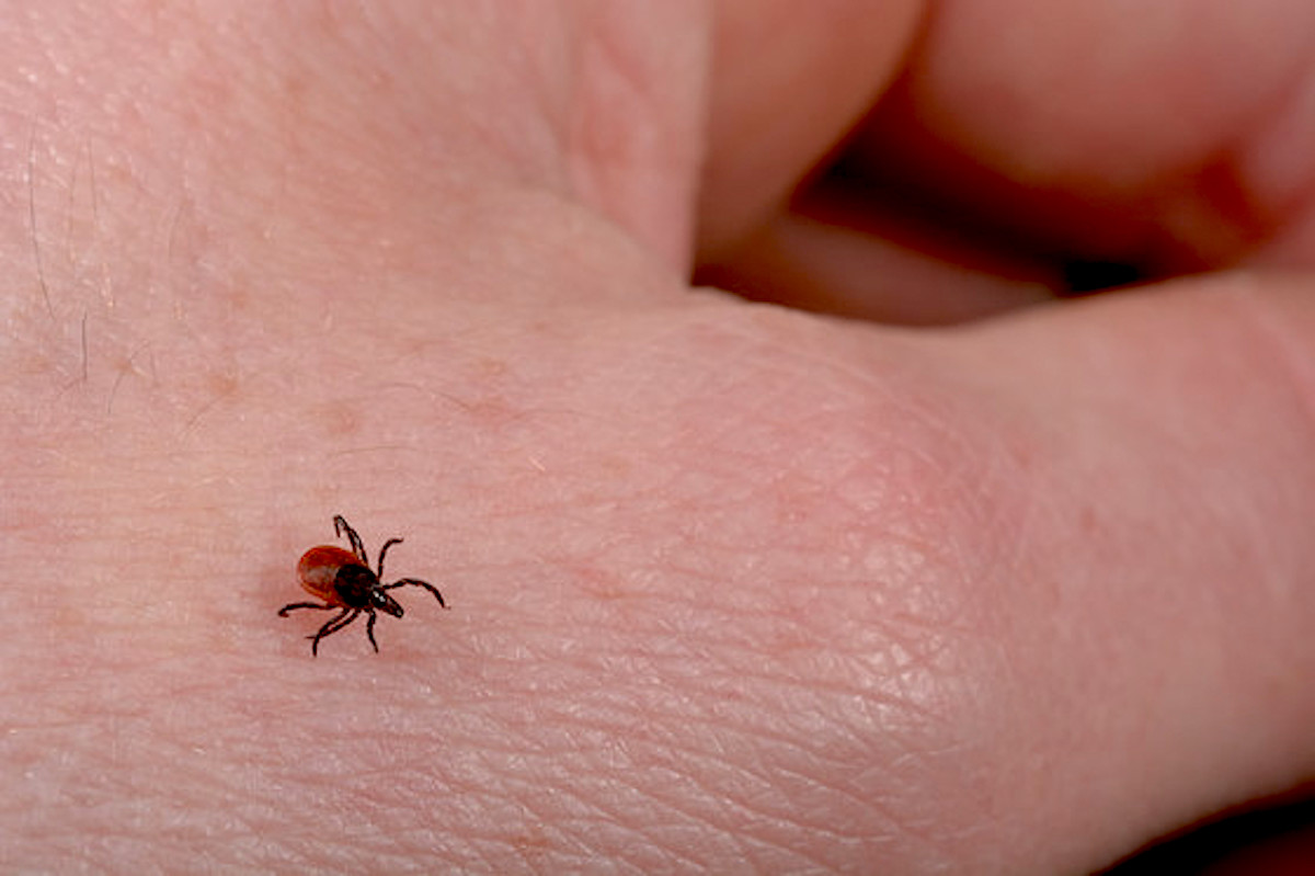 It's Tick Season. Here's What You Need to Know