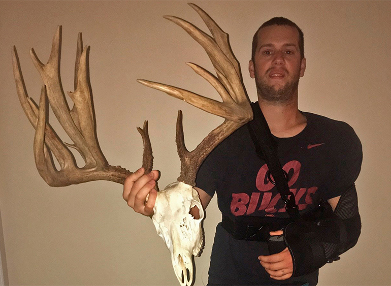 Ohio Bowhunter Postpones Surgery to Hunt Giant Non-Typical Buck